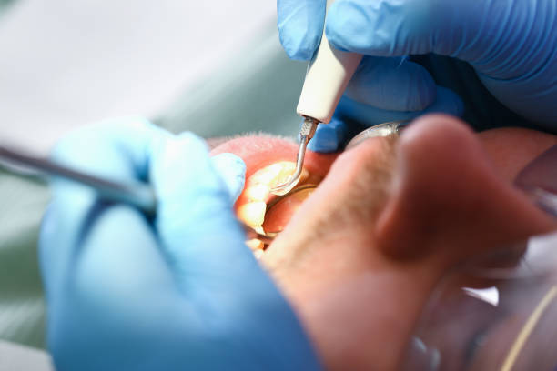 Best Broken or Cracked Tooth Emergency Dentist in Butler, GA